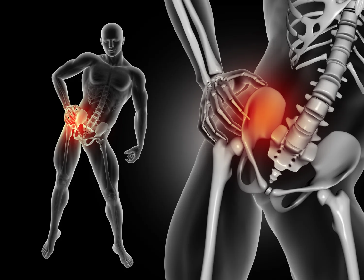 Tratamiento del dolor lumbar y ciática en CDMX: alivio especializado con neurocirugía